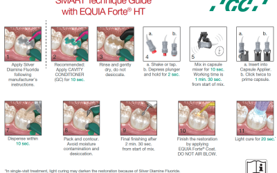 Play it SMART with EQUIA Forte® HT!